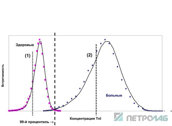 99 процентиль